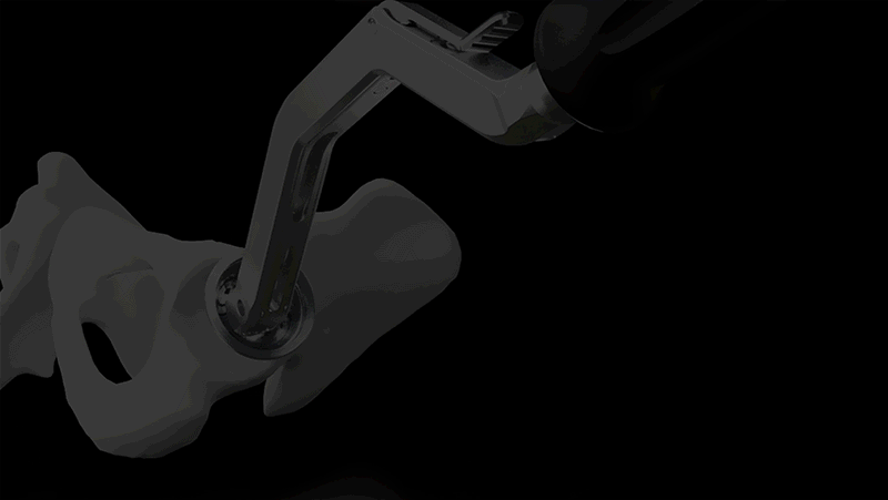 ENZTEC OCI X Workflow animated 2 sml