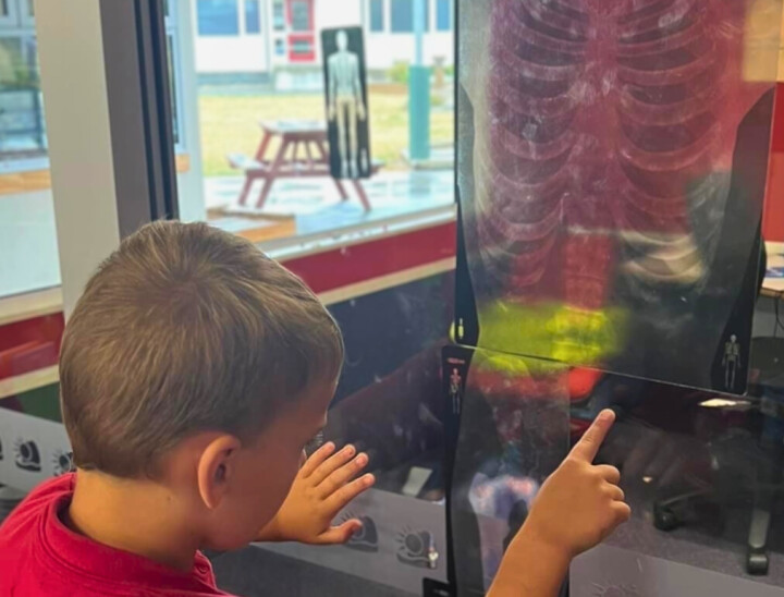 child looking at xray of skeleton Edited
